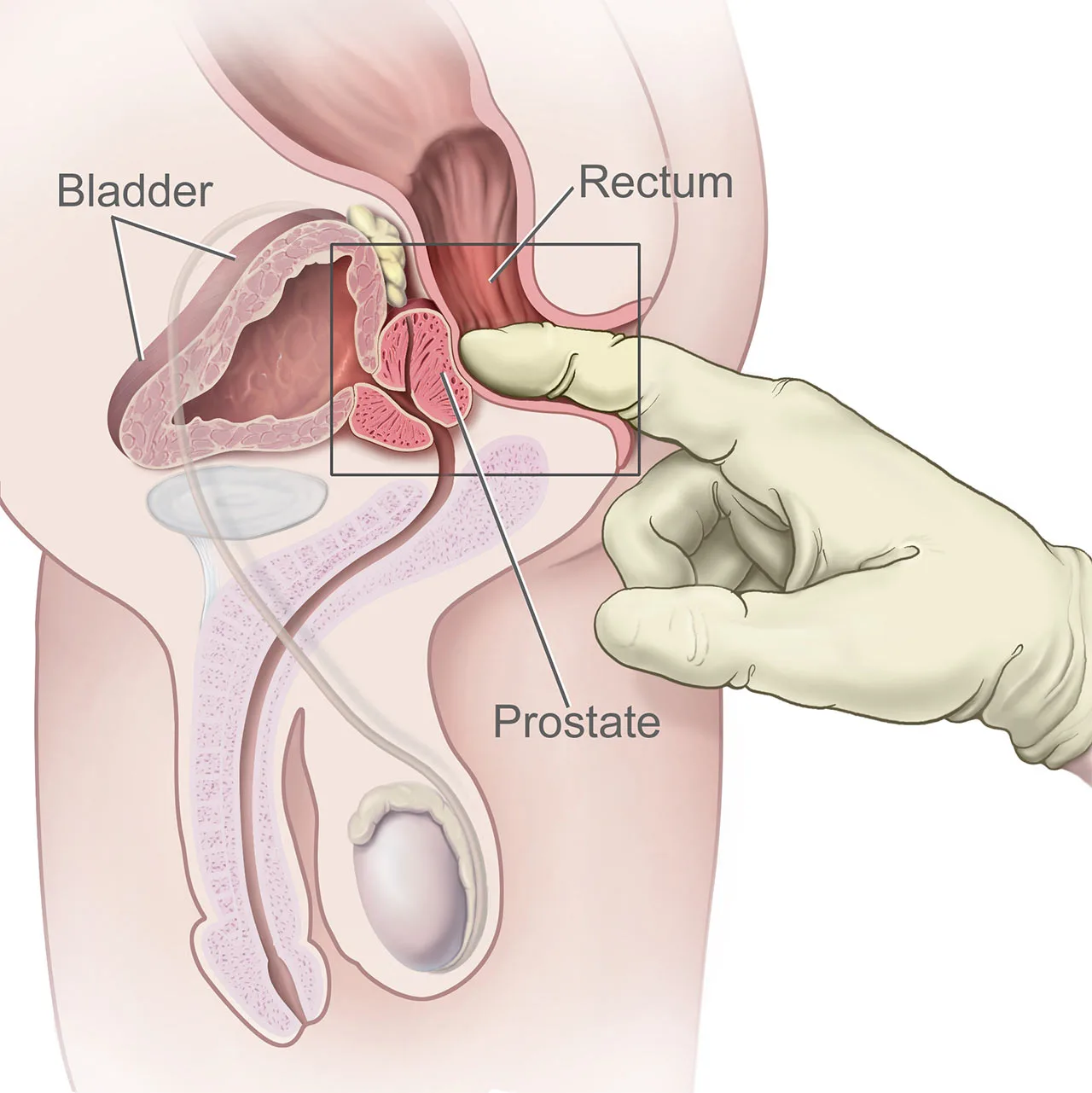 Prostate Massage in Bangkok